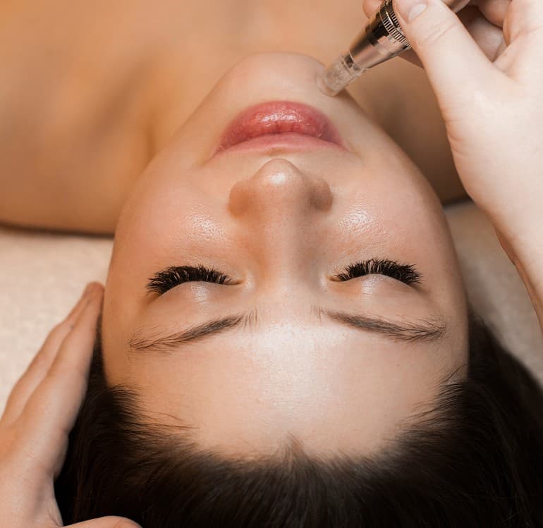 Microneedling facial treatment